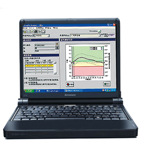 便携式骨密度检测仪厂家直销模式是星空体育给顾客让价的合理保障