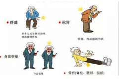 【骨密度仪】生产厂家星空体育谈骨质疏松患者,疏忽 2 点,补再多钙也没用!