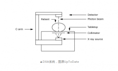 超声波【骨密度仪】器针对人体骨密度检测,你需要做吗?