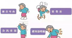 骨密度仪器生产厂家国康提醒一摔就骨折可能是骨质疏松引起的!